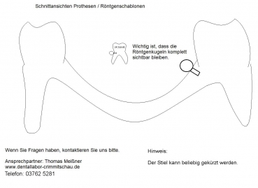 Hinweis Röntgenkugeln