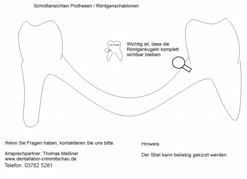 Hinweis Röntgenkugeln